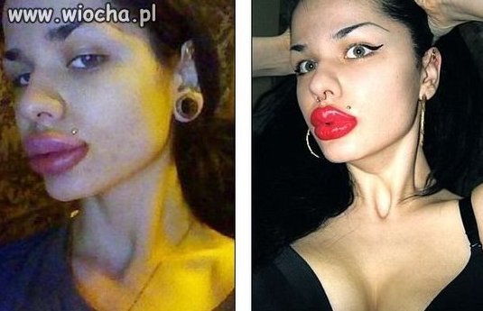 Dzióbek x 100