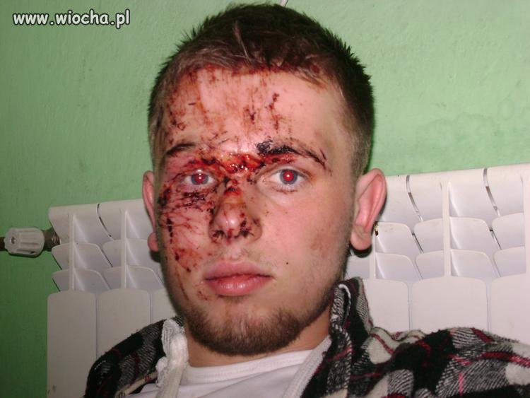 Halloween się skończyło