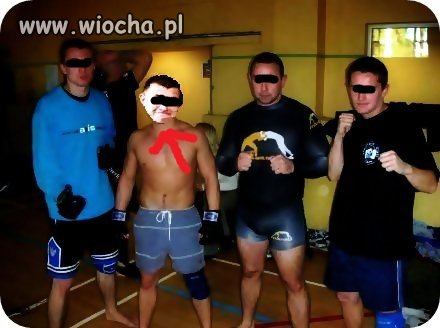 Mięśniak 