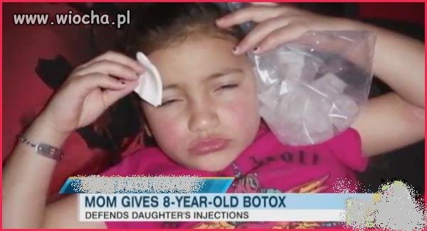 Tak męczy się dziecko któremu mamusia podaje botoks