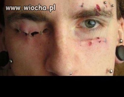 To nie tu sie zaszywa!