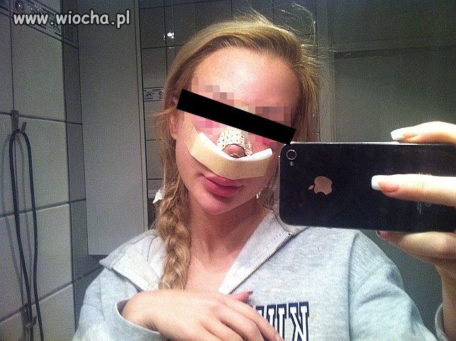 Kissie, kolejna operacja noska. 