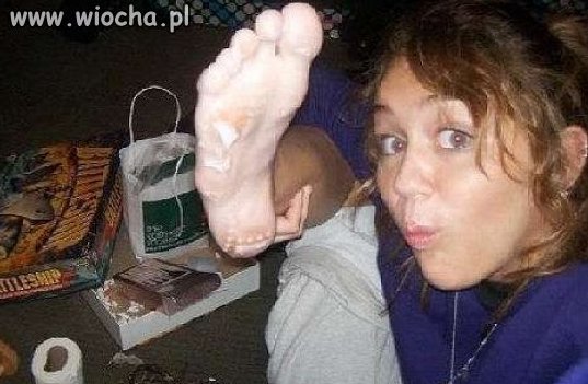 Ale stopa...