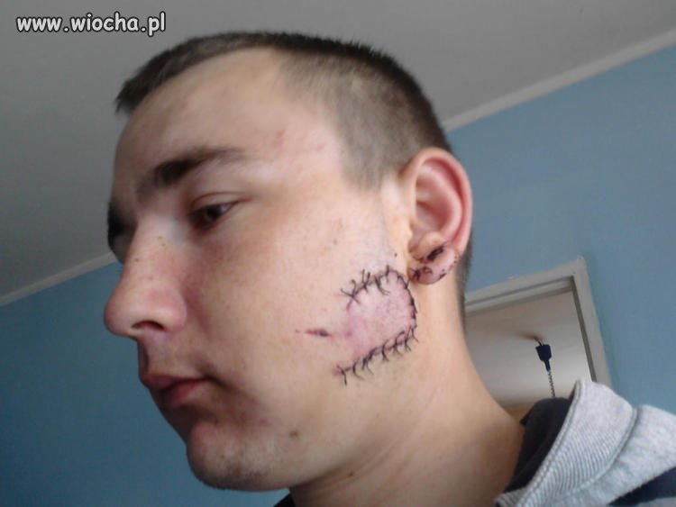 Kolejny debil co dostał po ryju i się tym chwali