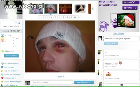Kolejny chwali się obitym ryjem na fotce