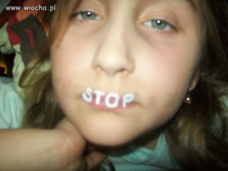 Stop