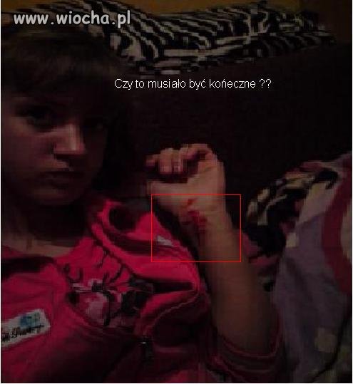 Nie ma to jak chwalenie się cięciem rąk 