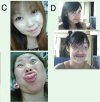 Miny...