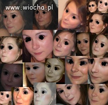 Paraliż szczęki