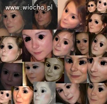 Paraliż szczęki