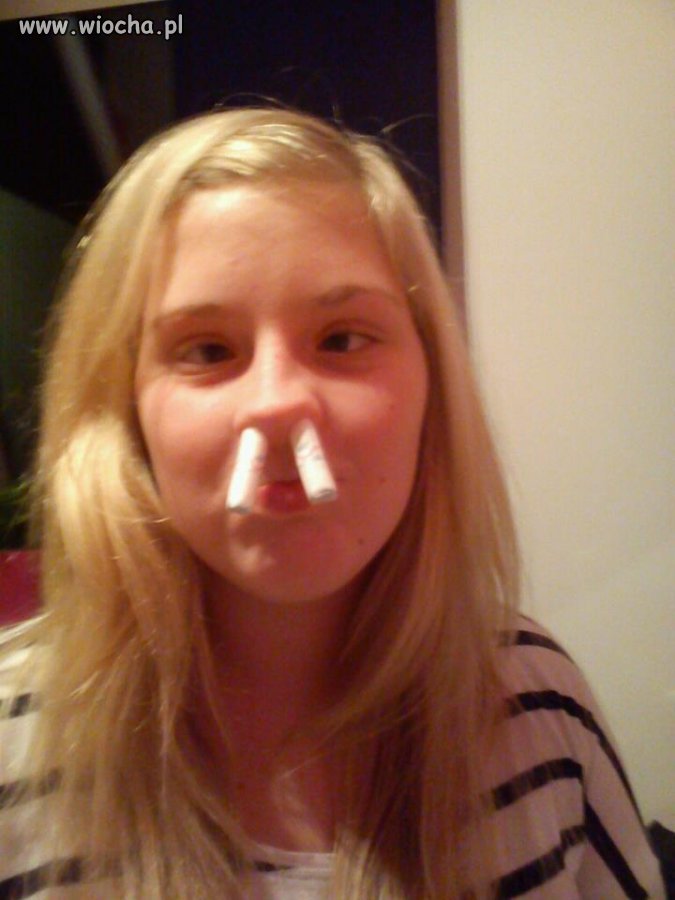 Laska z tamponami w nosie.