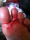 Japie***le