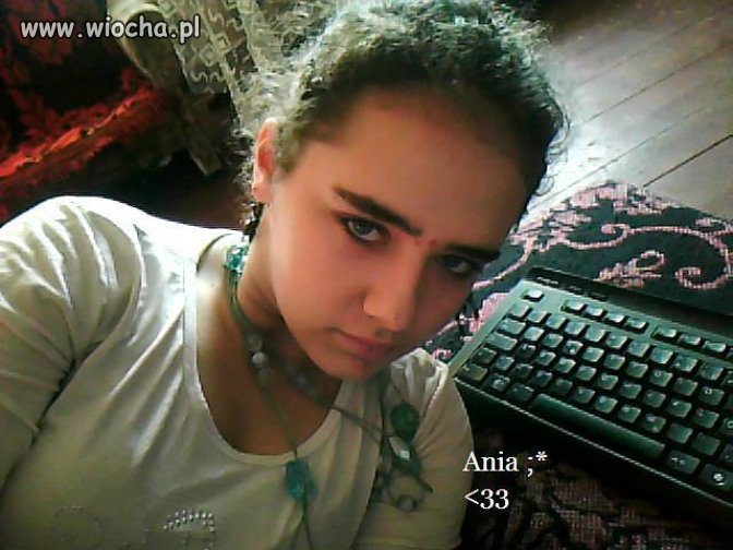 Mam nowego pryszcza na czole 