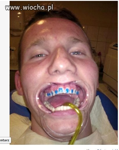 Moja pierwsza wizyta u dentysty