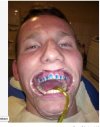 Moja pierwsza wizyta u dentysty
