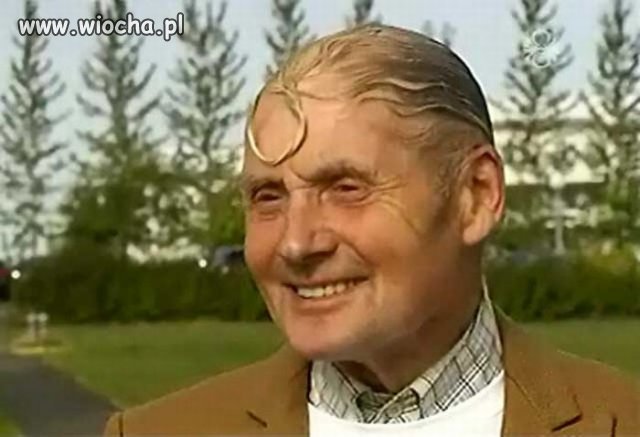 Próba ukrycia łysiny