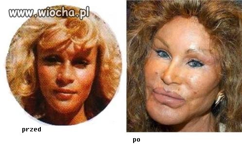 Co operacje plastyczne robią z ludźmi 