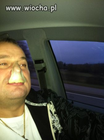 Patrzcie jak mu do twarzy z tą gumą na nosie