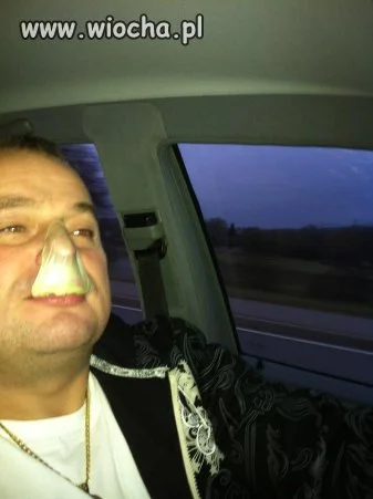 Patrzcie jak mu do twarzy z tą gumą na nosie