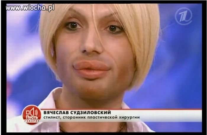 Chłopie coś ty ze sobą zrobił?!