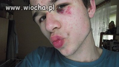 Nieważne, że morda obita
