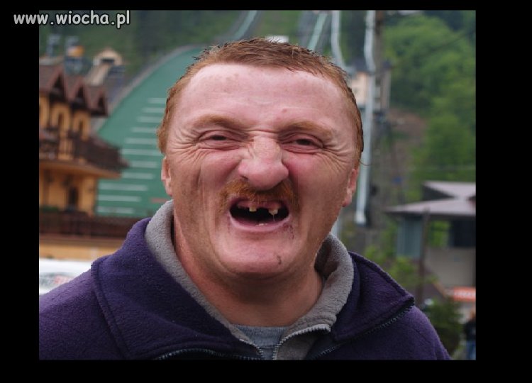 PZN W ZAKOPANYM