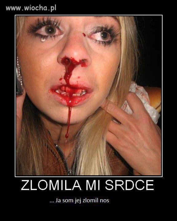 Złamała Mi serce.