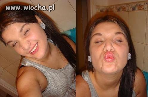 Choroba skrzywionego ryja 