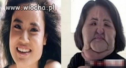 Uzależnienie od operacji plastycznych REAL