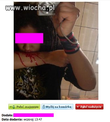 Zrobie zdjęcie jak sie pociąłem!