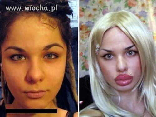 Przed i po. 