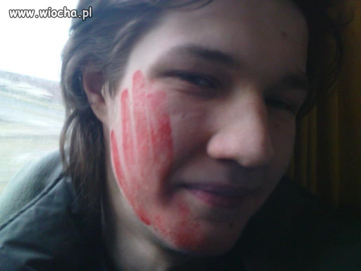 Plask na twarzy...
