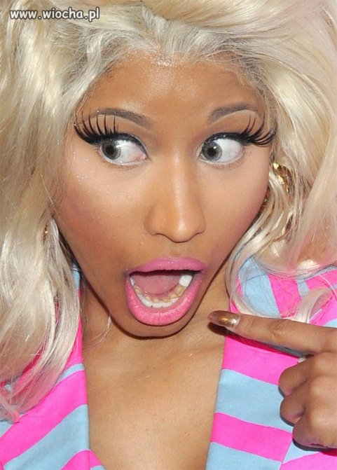 Tragicznie zrobione zęby Nicki Minaj