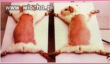 Wiwisekcja