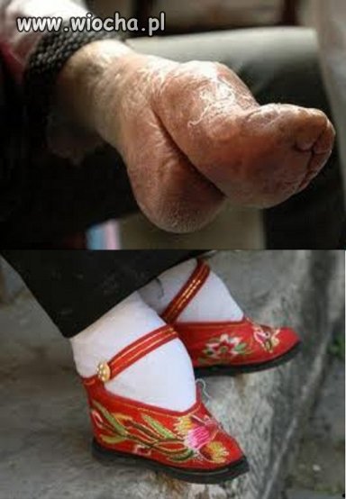 Krępowanie stóp w Chinach 