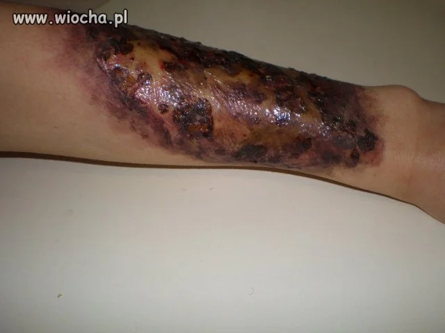 "Tylko chwila nieuwagi "
