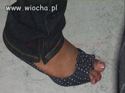 Open toe
