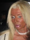 Ta opalenizna...