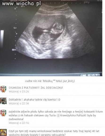 Komentarze mnie rozwaliły 