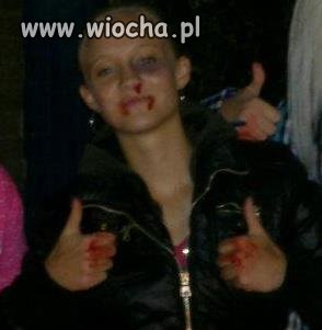 Opis pod zdjęciem