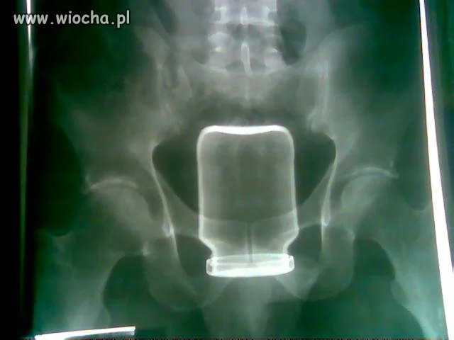 Zdjęcie podobno pochodzi z Gniezna
