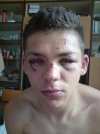Nie ma to jak oklepany ryj wrzucić na FB
