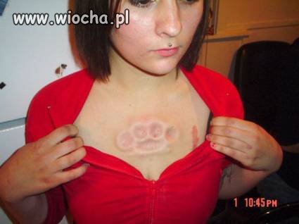 Kastet pod skórą