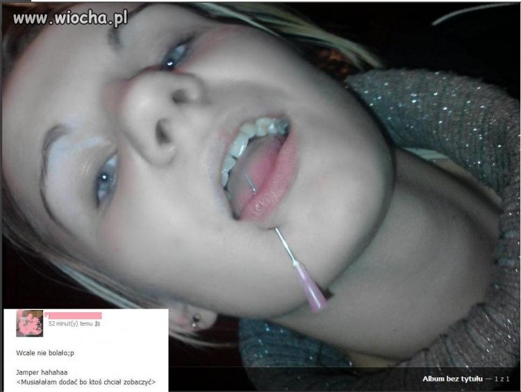 Krzywe zęby, głupia mina