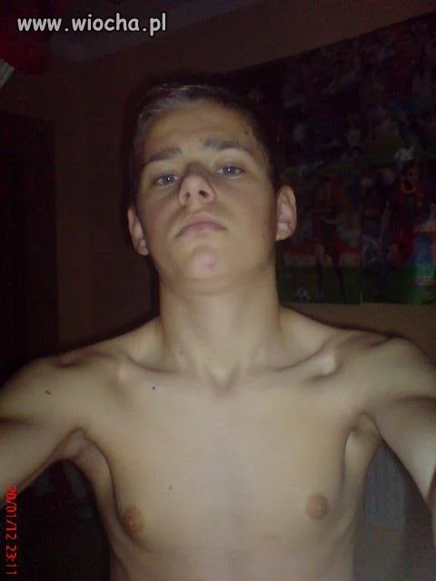 Zobaczcie moje plecy 