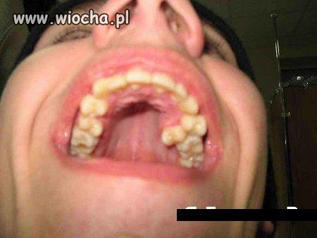 Co za wiochmen robi sobie takie fotki