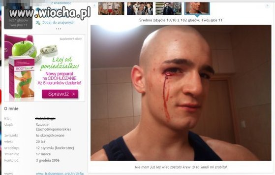 Pochwalić się wśród ogółu rozwaloną twarzą