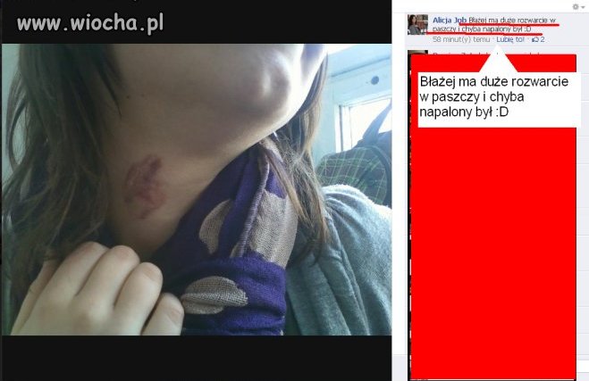 Błażej ma duże rozwarcie paszczy...