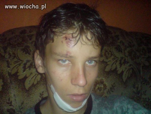 Po wczorajszej bójce...