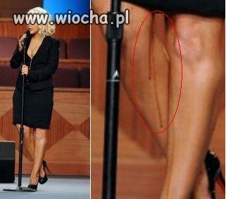 Ups...
